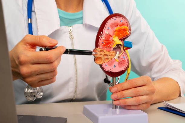 Best Urologist For kidney Stone Treatment in Thane